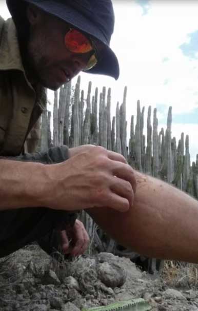 Preparing a wound with aloe from a desert cactus—the healing power of nature